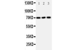 Western Blotting (WB) image for anti-Solute Carrier Family 6 (Neurotransmitter Transporter, serotonin), Member 4 (SLC6A4) (AA 7-24), (N-Term) antibody (ABIN3043084)