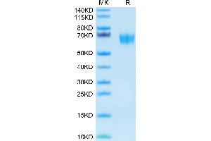 Human SERPINF2 on Tris-Bis PAGE under reduced condition. (alpha 2 Antiplasmin Protein (AA 28-491) (His tag))