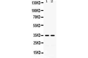 Western blot analysis of LFA3 expression in HELA whole cell lysates ( Lane 1) and K562 whole cell lysates ( Lane 2). (CD58 antibody  (AA 29-215))