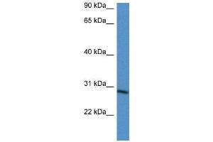 WB Suggested Anti-BARX2  Antibody Titration: 0. (BARX Homeobox 2 antibody  (N-Term))