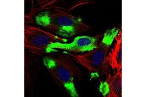 Immunofluorescence analysis of Hela cells using CD22 mouse mAb (green). (CD22 antibody  (AA 621-725))