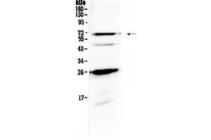 Western blot analysis of SLC7A3 using anti-SLC7A3 antibody .