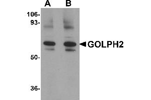 Western Blotting (WB) image for anti-Golgi Membrane Protein 1 (GOLM1) (Middle Region) antibody (ABIN1030941) (GOLM1 antibody  (Middle Region))