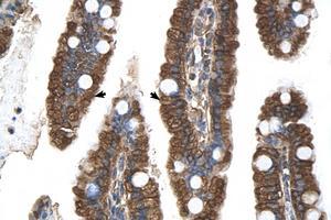 Image no. 1 for anti-Progesterone Receptor Membrane Component 1 (PGRMC1) (N-Term) antibody (ABIN6738268) (PGRMC1 antibody  (N-Term))