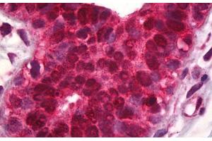 Anti-PDCD4 antibody IHC staining of human breast.