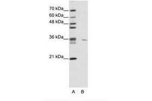 Use1 antibody  (N-Term)