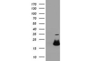Western Blotting (WB) image for anti-Retinoblastoma Binding Protein 9 (RBBP9) antibody (ABIN1500628) (RBBP9 antibody)