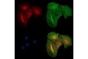 ABIN6264124 and ABIN6277517 staining  cells by IF/ICC. (PDZK1 antibody  (C-Term))