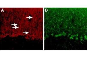 Expression of P2RY4 in rat cerebellum - Immunohistochemical staining of rat cerebellum using Anti-P2Y4 Receptor Antibody (ABIN7043589, ABIN7045078 and ABIN7045079).