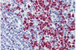 Spleen, Human: Formalin-Fixed, Paraffin-Embedded (FFPE) (RASSF2 antibody  (AA 11-22))
