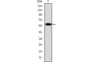 Western blot analysis using FGG mAb against human FGG (AA: 210-437) recombinant protein. (FGG antibody)