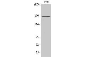 Western Blotting (WB) image for anti-Fanconi Anemia, Complementation Group D2 (FANCD2) (Ser371) antibody (ABIN3184593) (FANCD2 antibody  (Ser371))