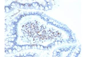 Immunohistochemistry (IHC) image for anti-BMI1 Polycomb Ring Finger Oncogene (BMI1) (AA 142-326) antibody (ABIN6940580)