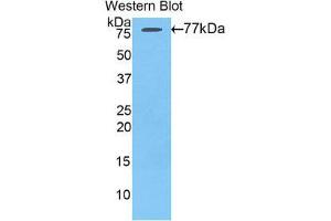 Western Blotting (WB) image for anti-Angiotensinogen (serpin Peptidase Inhibitor, Clade A, Member 8) (AGT) (AA 35-485) antibody (ABIN1857947)