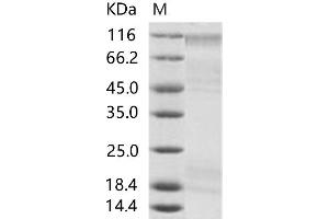 Western Blotting (WB) image for Sudan Ebola Virus Envelope Glycoprotein (SEBOV GP) protein (His tag) (ABIN7198907) (SEBOV GP Protein (His tag))