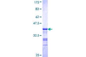 Image no. 1 for ALX Homeobox 1 (ALX1) (AA 198-306) protein (GST tag) (ABIN1344958) (ALX1 Protein (AA 198-306) (GST tag))