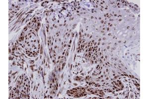 IHC-P Image Immunohistochemical analysis of paraffin-embedded Cal27 xenograft, using CTDP1 , antibody at 1:100 dilution.