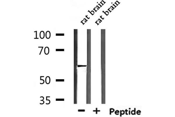 ZNF280B antibody  (C-Term)