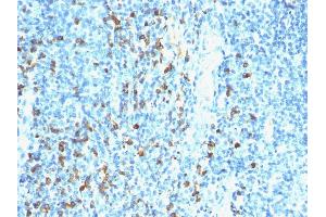 Formalin-fixed, paraffin-embedded human Tonsil stained with Biotinylated Lambda Light Chain probe followed by Anti-Biotin Mouse Monoclonal Antibody (Hyb-8). (Biotin antibody)