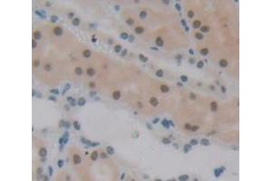 IHC-P analysis of Human Tissue, with DAB staining. (Polybromo 1 antibody  (AA 957-1086))