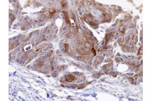 IHC-P Image Immunohistochemical analysis of paraffin-embedded SCC15 xenograft, using OSBPL6 , antibody at 1:100 dilution. (OSBPL6 antibody  (C-Term))
