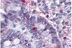 Image no. 1 for anti-Leucine-Rich Repeat Containing G Protein-Coupled Receptor 5 (LGR5) (Cytoplasmic Domain) antibody (ABIN1048834) (LGR5 antibody  (Cytoplasmic Domain))