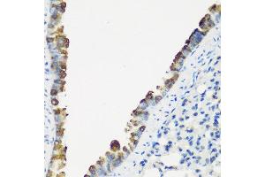 Immunohistochemistry of paraffin-embedded mouse lung using TNNC2 antibody at dilution of 1:200 (40x lens).