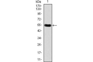 Western blot analysis using DKK3 antibody against HEK293 (1) and DKK3 (AA: 91-350) -hIgGFc transfected HEK293 (2) cell lysate.