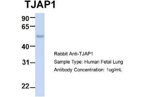 Host:  Rabbit  Target Name:  TJAP1  Sample Type:  Human Fetal Lung  Antibody Dilution:  1. (TJAP1 antibody  (N-Term))