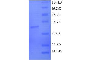 SDS-PAGE (SDS) image for Claudin 3 (CLDN3) (AA 30-80), (partial) protein (GST tag) (ABIN1046824) (Claudin 3 Protein (CLDN3) (AA 30-80, partial) (GST tag))