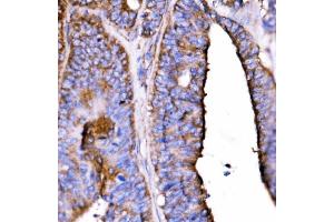 IHC analysis of 5HT1B/HTR1B using anti-5HT1B/HTR1B antibody (ABIN7601425). (5HT1B Receptor antibody  (AA 35-390))