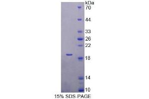 SDS-PAGE analysis of Mouse TBCA Protein.