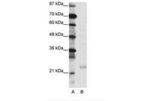 Image no. 1 for anti-TAF10 RNA Polymerase II, TATA Box Binding Protein (TBP)-Associated Factor, 30kDa (TAF10) (C-Term) antibody (ABIN6736086) (TAF10 antibody  (C-Term))