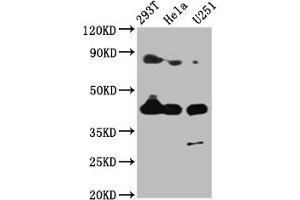 Western Blot Positive WB detected in: 293T whole cell lysate, Hela whole cell lysate, U251 whole cell lysate All lanes: MSTN antibody at 4 μg/mL Secondary Goat polyclonal to rabbit IgG at 1/50000 dilution Predicted band size: 43 kDa Observed band size: 43 kDa (MSTN antibody  (AA 267-375))