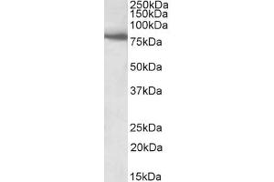 ABIN5539484 (1µg/ml) staining of Human Skeletal Muscle lysate (35µg protein in RIPA buffer). (BBS7 antibody  (Internal Region))