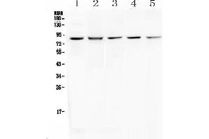 Western blot analysis of RNF43 using anti-RNF43 antibody . (RNF43 antibody  (AA 24-197))