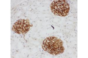 Anti-CD34 antibody, IHC(F) IHC(F): Rat Kidney Tissue (CD34 antibody  (C-Term))