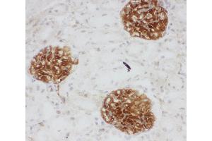 Immunohistochemistry (IHC) image for anti-CD34 (CD34) (AA 366-382), (C-Term) antibody (ABIN3044374)