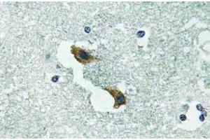 Immunohistochemistry (IHC) analyzes of ATP7A antibody in paraffin-embedded human brain tissue.