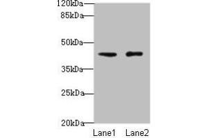 Western blot All lanes: VPS45 antibody at 3 μg/mL Lane 1: Mouse brain tissue Lane 2: U87 whole cell lysate Secondary Goat polyclonal to rabbit IgG at 1/10000 dilution Predicted band size: 66, 62 kDa Observed band size: 41 kDa (VPS45 antibody  (AA 101-400))