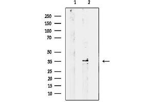 anti-Syntaxin 11 (STX11) (Internal Region) antibody