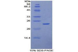 SDS-PAGE (SDS) image for Intercellular Adhesion Molecule 4 (ICAM4) (AA 52-234) protein (His tag) (ABIN1879123)