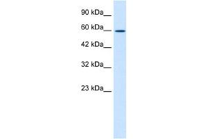 WB Suggested Anti-ZNF12 Antibody Titration:  1. (ZNF12 antibody  (N-Term))