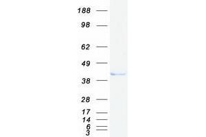 Potassium Channel Tetramerisation Domain Containing 9 (KCTD9) protein (Myc-DYKDDDDK Tag)