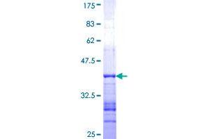 GRID2 Protein (AA 908-1007) (GST tag)