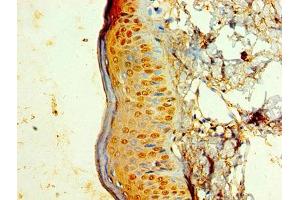 Immunohistochemistry of paraffin-embedded human skin tissue using ABIN7157433 at dilution of 1:100 (KRT6A antibody  (AA 2-564))