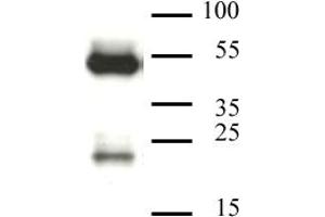 CAF-1 p60 antibody (mAb) tested by Western blot. (CHAF1B antibody)