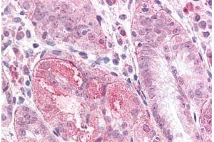 Human Stomach: Formalin-Fixed, Paraffin-Embedded (FFPE) (TMEM33 antibody  (Internal Region))