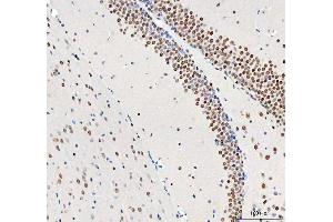 IHC analysis of DDX1 using anti-DDX1 antibody (ABIN7602052). (DDX1 antibody  (AA 562-740))