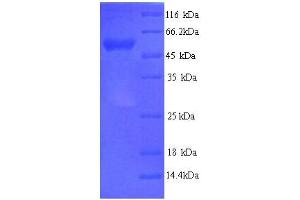 SDS-PAGE (SDS) image for Adaptor-Related Protein Complex 2, mu 1 Subunit (AP2M1) (AA 1-435), (full length) protein (His tag) (ABIN5713232) (AP2M1 Protein (AA 1-435, full length) (His tag))